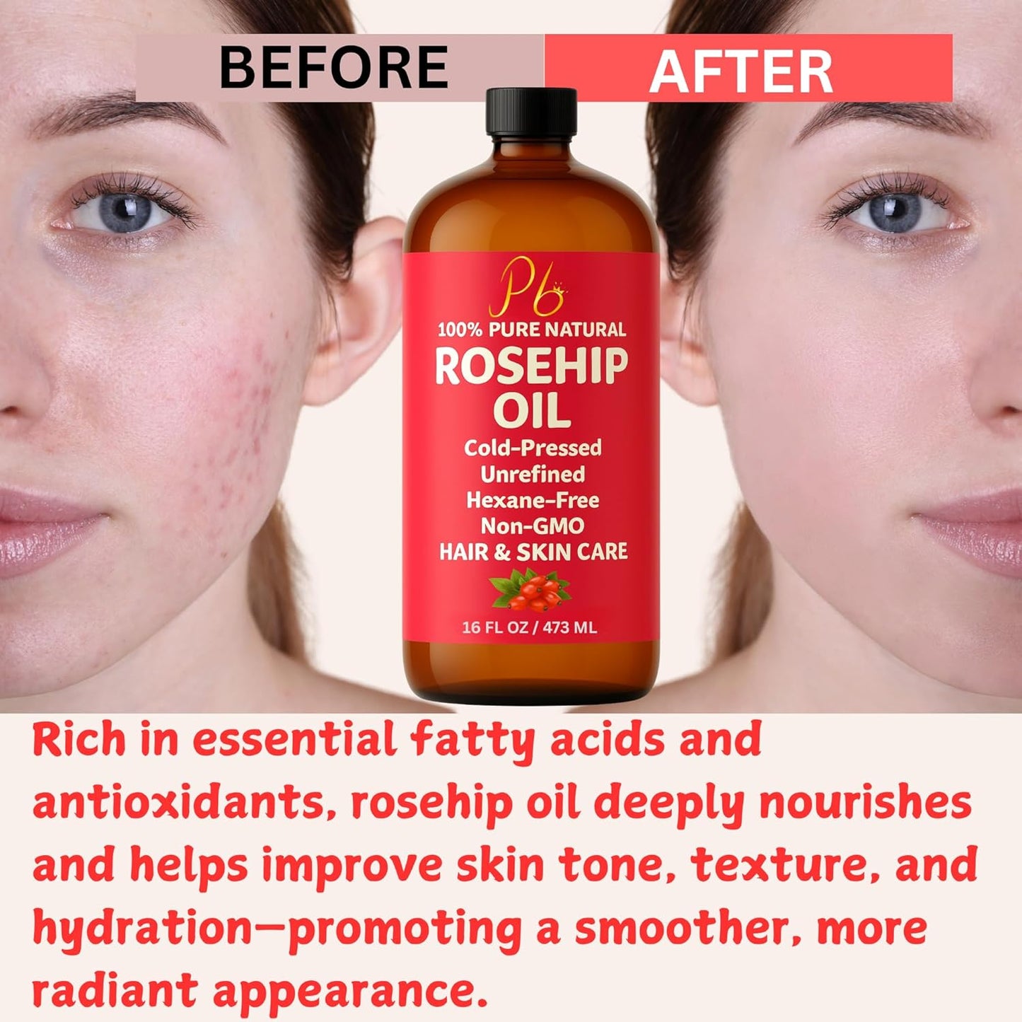 Rosehip Oil – 16 fl oz Glass Bottle with Pump – Cold-Pressed & Unrefined, Rosehip Oil for Face, Skin & Hair – Natural Moisturizer for Scars, Wrinkles, Stretch Marks & Gua Sha Massage