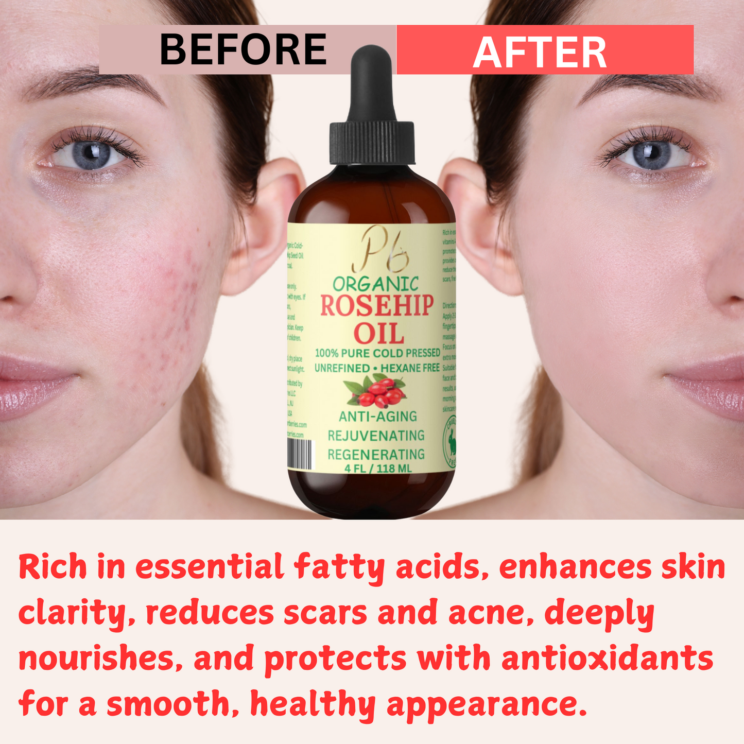 Organic Rosehip Oil for Face & Skin – 4 fl oz | Cold-Pressed Rose Hip Seed Oil | Anti-Aging Facial Oil | Reduces Wrinkles | Rich in Vitamin C, Retinol & Fatty Acids | Glass Bottle