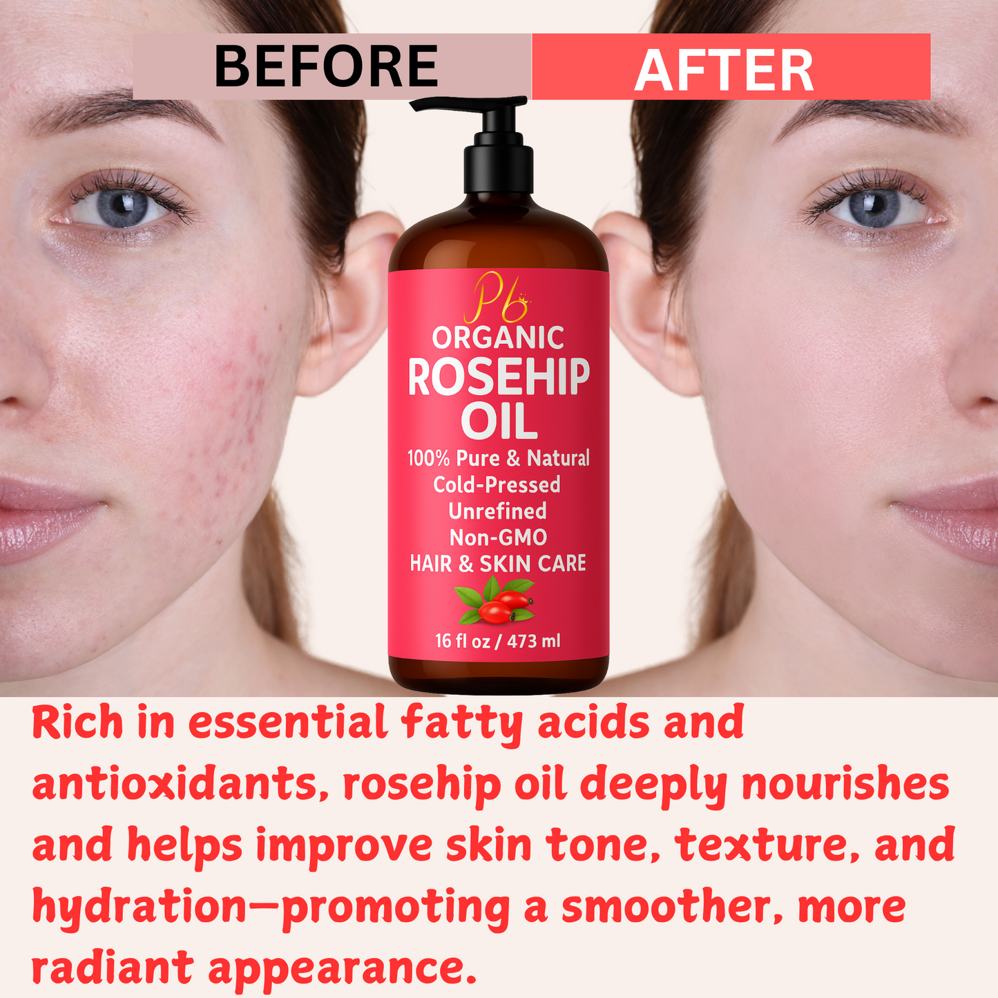 Organic Cold Pressed Rosehip Oil – 16 fl oz | Unrefined, Hexane-Free, Glass Bottle with Pump | Face, Body & Hair Moisturizer | Skin Brightening | Anti-Aging | Dark Spot Support