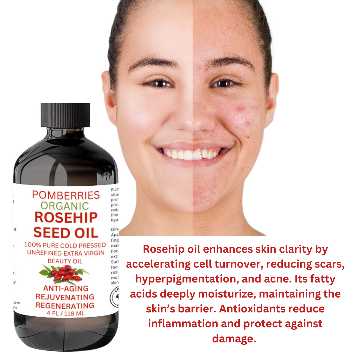 Rosehip Oil for Face & Skin, Organic Rosehip Seed Face Oil for Anti-Aging, Reduces Appearance of Wrinkles, Rich In Vitamin C, Retinol & Fatty Acids, Carrier Oil- Glass Bottle 4 fl oz